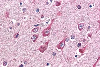 Anti-O-GlcNAc transferase antibody, Internal used in IHC (Paraffin sections) (IHC-P). GTX89131