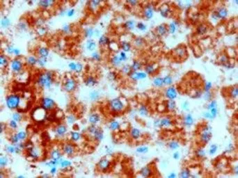 Anti-DGAT2 antibody, Internal used in IHC (Paraffin sections) (IHC-P). GTX89134