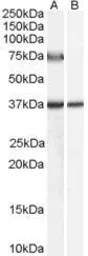 Anti-ACOX2 antibody, Internal used in Western Blot (WB). GTX89135