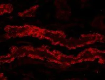 Anti-GPX3 antibody, Internal used in IHC (Frozen sections) (IHC-Fr). GTX89142