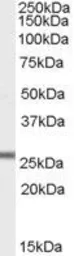 Anti-GPX3 antibody, Internal used in Western Blot (WB). GTX89142