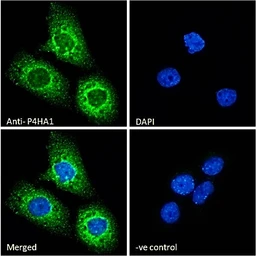 Anti-P4HA1 antibody, Internal used in Immunocytochemistry/ Immunofluorescence (ICC/IF). GTX89145