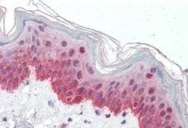 Anti-P4HA1 antibody, Internal used in IHC (Paraffin sections) (IHC-P). GTX89145