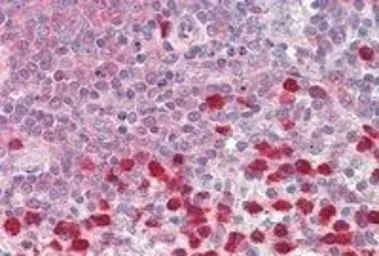 Anti-P4HA1 antibody, Internal used in IHC (Paraffin sections) (IHC-P). GTX89145