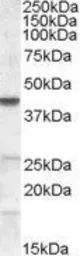 Anti-ABHD5 antibody, Internal used in Western Blot (WB). GTX89147