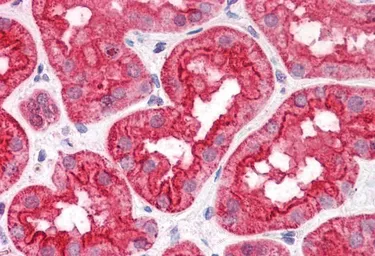 Anti-ABHD5 antibody, Internal used in IHC (Paraffin sections) (IHC-P). GTX89147