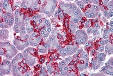 Anti-ABHD5 antibody, Internal used in IHC (Paraffin sections) (IHC-P). GTX89147
