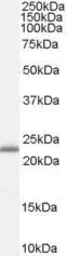 Anti-RBP4 antibody, Internal used in Western Blot (WB). GTX89148