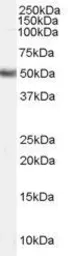 Anti-FADS1 antibody, Internal used in Western Blot (WB). GTX89153