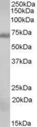 Anti-RAD9A antibody, C-term used in Western Blot (WB). GTX89156