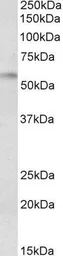 Anti-DGAT1 antibody, Internal used in Western Blot (WB). GTX89164