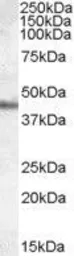 Anti-Apolipoprotein A4 antibody, Internal used in Western Blot (WB). GTX89166