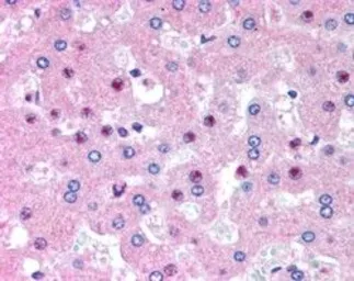 Anti-C14orf68 (aa242-254) antibody, Internal used in IHC (Paraffin sections) (IHC-P). GTX89170