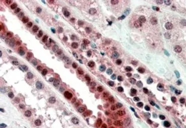 Anti-TCF3 / E2A antibody, Internal used in IHC (Paraffin sections) (IHC-P). GTX89171