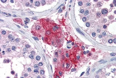 Anti-ACYP1 (isoform a) antibody, Internal used in IHC (Paraffin sections) (IHC-P). GTX89173