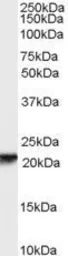 Anti-RBP4 antibody, Internal used in Western Blot (WB). GTX89178