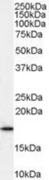 Anti-ARF1 antibody, C-term used in Western Blot (WB). GTX89179