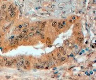 Anti-Semaphorin 3E antibody, Internal used in IHC (Paraffin sections) (IHC-P). GTX89180