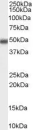 Anti-MBD2 (isoform 1) antibody, Internal used in Western Blot (WB). GTX89182