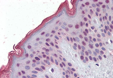 Anti-MBD2 (isoform 1) antibody, Internal used in IHC (Paraffin sections) (IHC-P). GTX89182