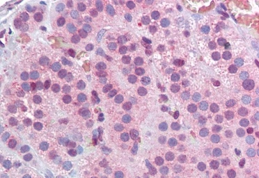 Anti-MBD2 (isoform 1) antibody, Internal used in IHC (Paraffin sections) (IHC-P). GTX89182