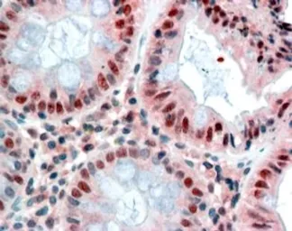 Anti-MBD2 (isoform 1) antibody, Internal used in IHC (Paraffin sections) (IHC-P). GTX89182