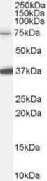 Anti-NEDD1 antibody, Internal used in Western Blot (WB). GTX89186