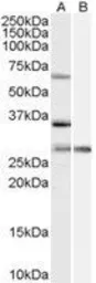 Anti-PRPF31 antibody, Internal used in Western Blot (WB). GTX89187