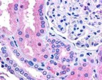 Anti-RNF213 antibody, C-term used in IHC (Paraffin sections) (IHC-P). GTX89188