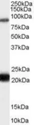 Anti-RASAL1 antibody, C-term used in Western Blot (WB). GTX89190