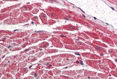 Anti-PI3 kinase p110 alpha antibody, Internal used in IHC (Paraffin sections) (IHC-P). GTX89196