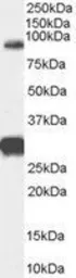 Anti-FOXP2 antibody, Internal used in Western Blot (WB). GTX89199