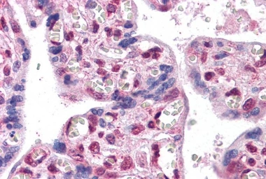 Anti-FOXP2 antibody, Internal used in IHC (Paraffin sections) (IHC-P). GTX89199