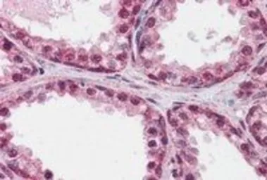 Anti-FOXP2 antibody, Internal used in IHC (Paraffin sections) (IHC-P). GTX89199