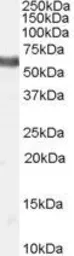 Anti-NUR77 (isoform a) antibody, Internal used in Western Blot (WB). GTX89206