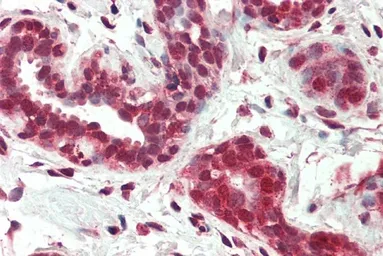 Anti-NUR77 (isoform a) antibody, Internal used in IHC (Paraffin sections) (IHC-P). GTX89206