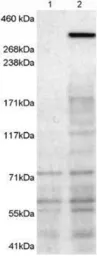 Anti-Neurobeachin antibody, C-term used in Western Blot (WB). GTX89207