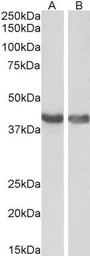 Anti-HEXIM1 antibody, C-term used in Western Blot (WB). GTX89214