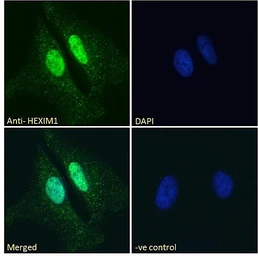Anti-HEXIM1 antibody, C-term used in Immunocytochemistry/ Immunofluorescence (ICC/IF). GTX89214