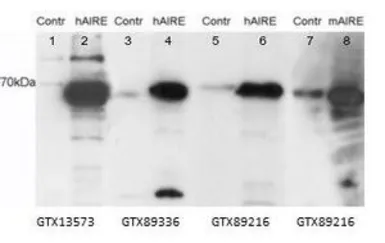Anti-AIRE (isoforms 1 + 2) antibody, Internal used in Western Blot (WB). GTX89216