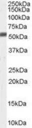 Anti-ZMPSTE24 antibody, C-term used in Western Blot (WB). GTX89219
