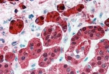 Anti-RKIP antibody, Internal used in IHC (Paraffin sections) (IHC-P). GTX89220