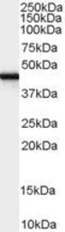 Anti-FEZ1 antibody, Internal used in Western Blot (WB). GTX89222