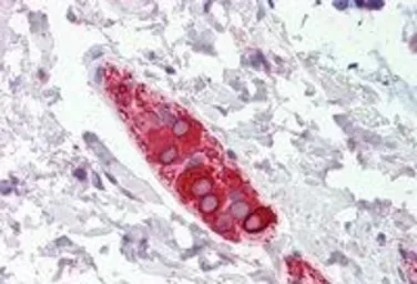 Anti-FEZ1 antibody, Internal used in IHC (Paraffin sections) (IHC-P). GTX89222