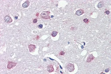 Anti-FEZ1 antibody, Internal used in IHC (Paraffin sections) (IHC-P). GTX89222