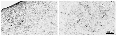 Anti-GFAP antibody, C-term used in IHC (Frozen sections) (IHC-Fr). GTX89226