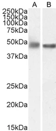 Anti-GFAP antibody, C-term used in Western Blot (WB). GTX89226