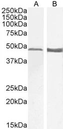Anti-GFAP antibody, C-term used in Western Blot (WB). GTX89226