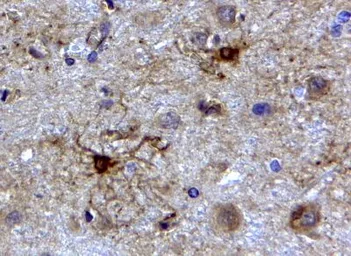 Anti-GFAP antibody, C-term used in IHC (Paraffin sections) (IHC-P). GTX89226