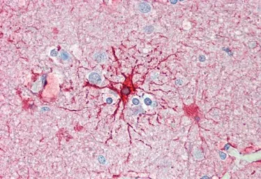 Anti-GFAP antibody, C-term used in IHC (Paraffin sections) (IHC-P). GTX89226